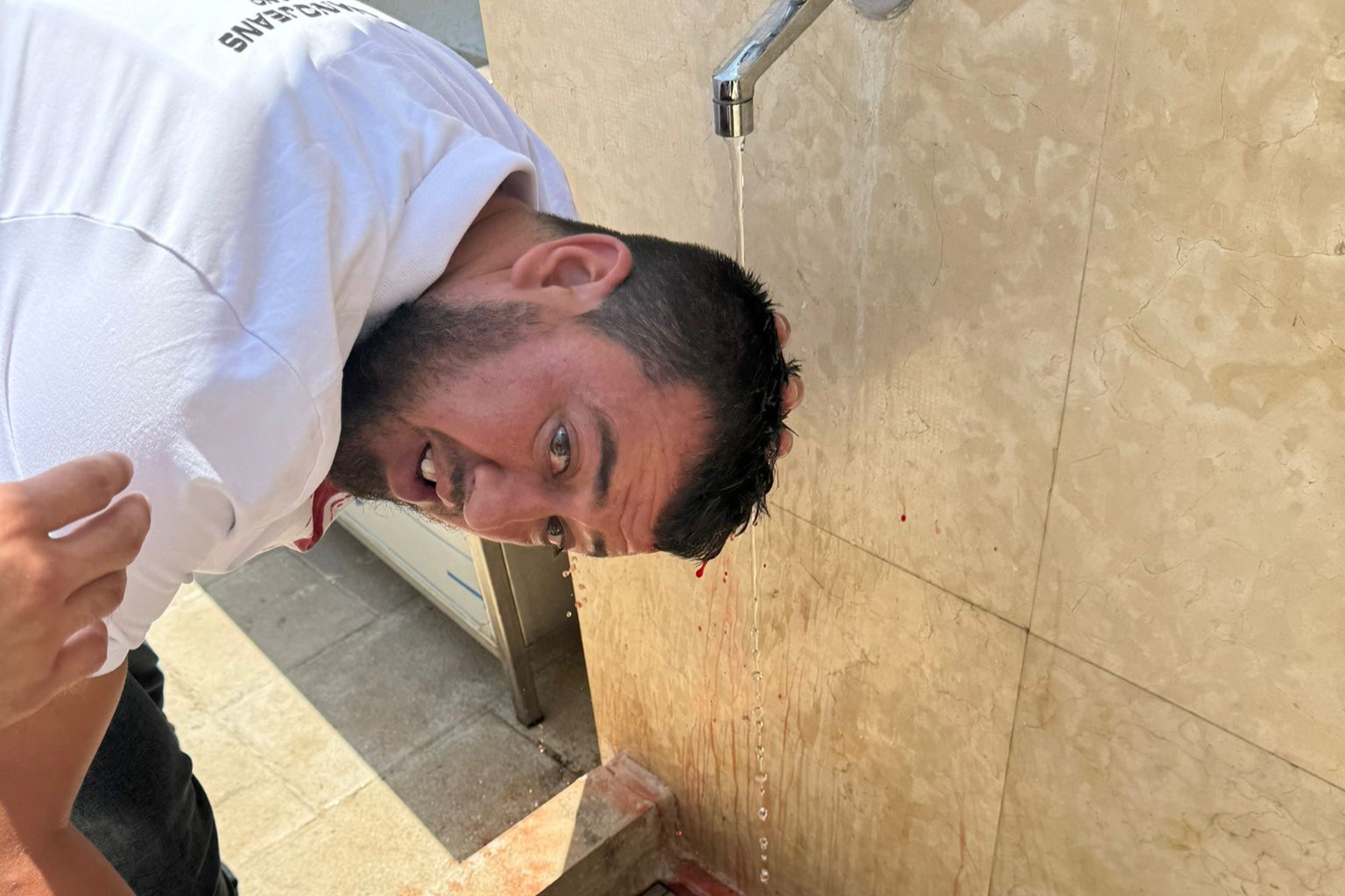 الشاب الذي تعرض للاعتداء من قوات الاحتلال الإسرائيلي في القدس 